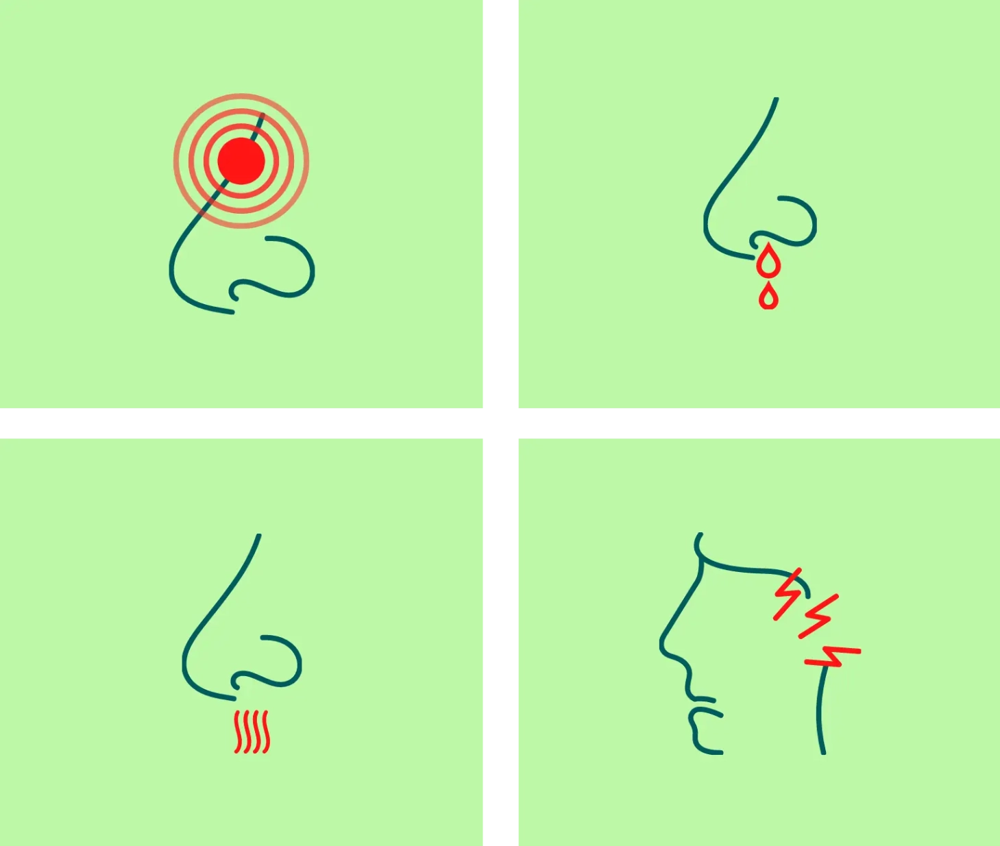 Illustration der vier Symptome einer chronischen Rhinosinusitis mit Nasenpolypen: Schmerzende Nasennebenhöhlen, eine laufende Nase, ein eingeschränkter Geruchssinn und Geschmackssinn sowie Schmerzen oder Druckgefühle im Gesicht.